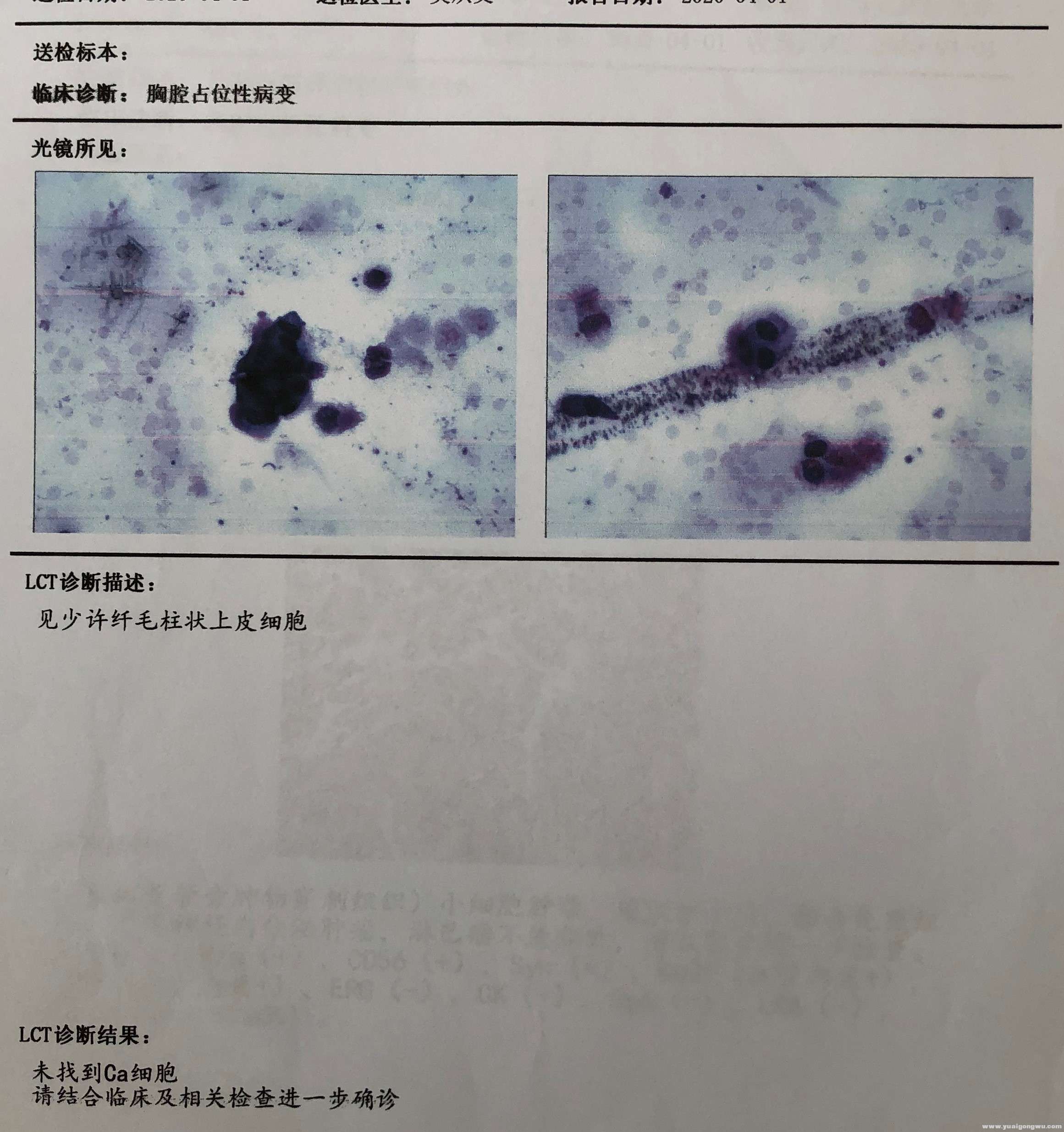 基液薄层细胞报告.jpg