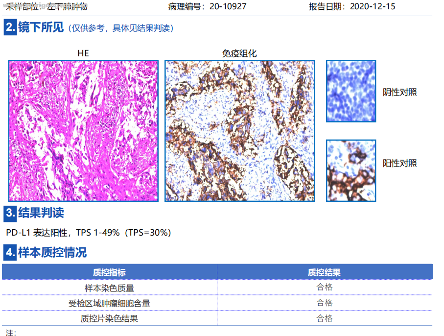 PD-L1显示结果