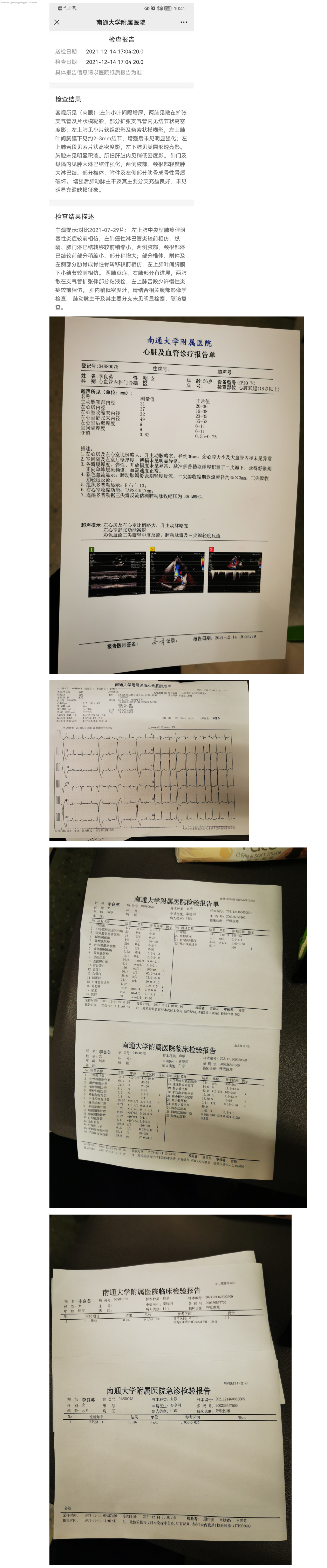 2021.12.14 CT 心电图 心超 血液.png