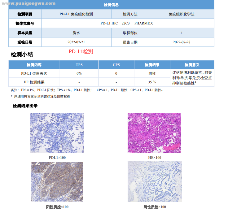 PD-L1检测.png