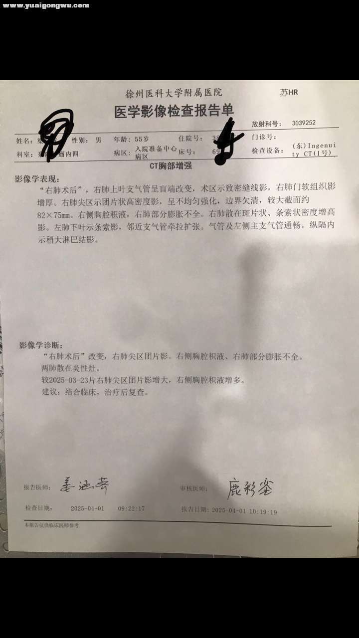 右肺上叶切除，术前术后对比
